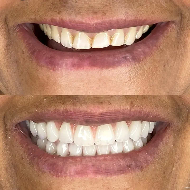 Caso real 3 — antes e depois