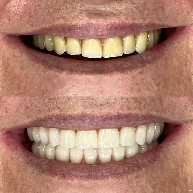 Caso real 4 — antes e depois