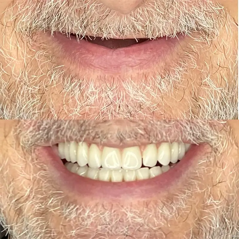 Caso real 5 — antes e depois